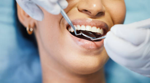 Best Emergency Treatment for Dental Infections or Abscesses in Seneca Knolls, NY