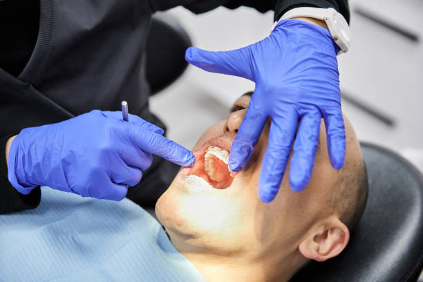 Best Emergency Dental Care for Broken or Chipped Teeth in Seneca Knolls, NY
